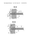 APICAL PUNCTURE ACCESS AND CLOSURE SYSTEM diagram and image