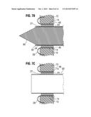 APICAL PUNCTURE ACCESS AND CLOSURE SYSTEM diagram and image