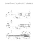 Method, Implant & Instruments for Percutaneous Expansion of the Spinal     Canal diagram and image