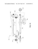 Method, Implant & Instruments for Percutaneous Expansion of the Spinal     Canal diagram and image