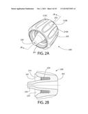 Method, Implant & Instruments for Percutaneous Expansion of the Spinal     Canal diagram and image