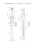 Method, Implant & Instruments for Percutaneous Expansion of the Spinal     Canal diagram and image