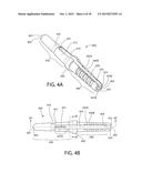 Method, Implant & Instruments for Percutaneous Expansion of the Spinal     Canal diagram and image