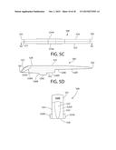 Method, Implant & Instruments for Percutaneous Expansion of the Spinal     Canal diagram and image