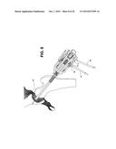 METHOD, DEVICE, AND SYSTEM FOR SHAVING AND SHAPING OF A JOINT diagram and image