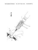 METHOD, DEVICE, AND SYSTEM FOR SHAVING AND SHAPING OF A JOINT diagram and image