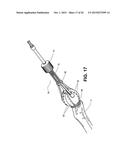 METHOD, DEVICE, AND SYSTEM FOR SHAVING AND SHAPING OF A JOINT diagram and image