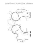 METHOD, DEVICE, AND SYSTEM FOR SHAVING AND SHAPING OF A JOINT diagram and image