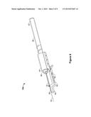 APPARATUS AND METHOD FOR ELONGATING A TENDON diagram and image