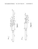 APPARATUS AND METHOD FOR ELONGATING A TENDON diagram and image