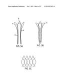 DEVICES AND METHODS FOR PERCUTANEOUS ENDARTERECTOMY diagram and image