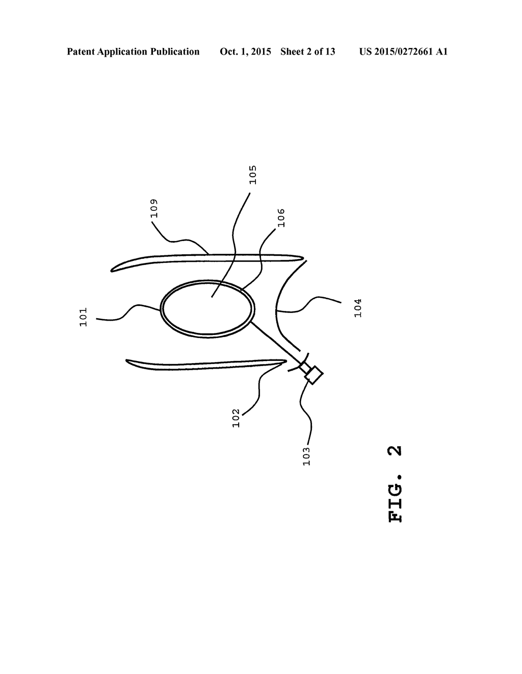 CAUTERY NEEDLE FOR SEPARATING AND/OR PENETRATING THE PERICARDIUM - diagram, schematic, and image 03