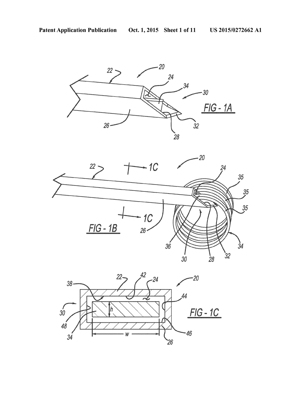 SYSTEM AND METHOD FOR PREDICTABLE DEPLOYMENT OF A MEDICAL DEVICE - diagram, schematic, and image 02