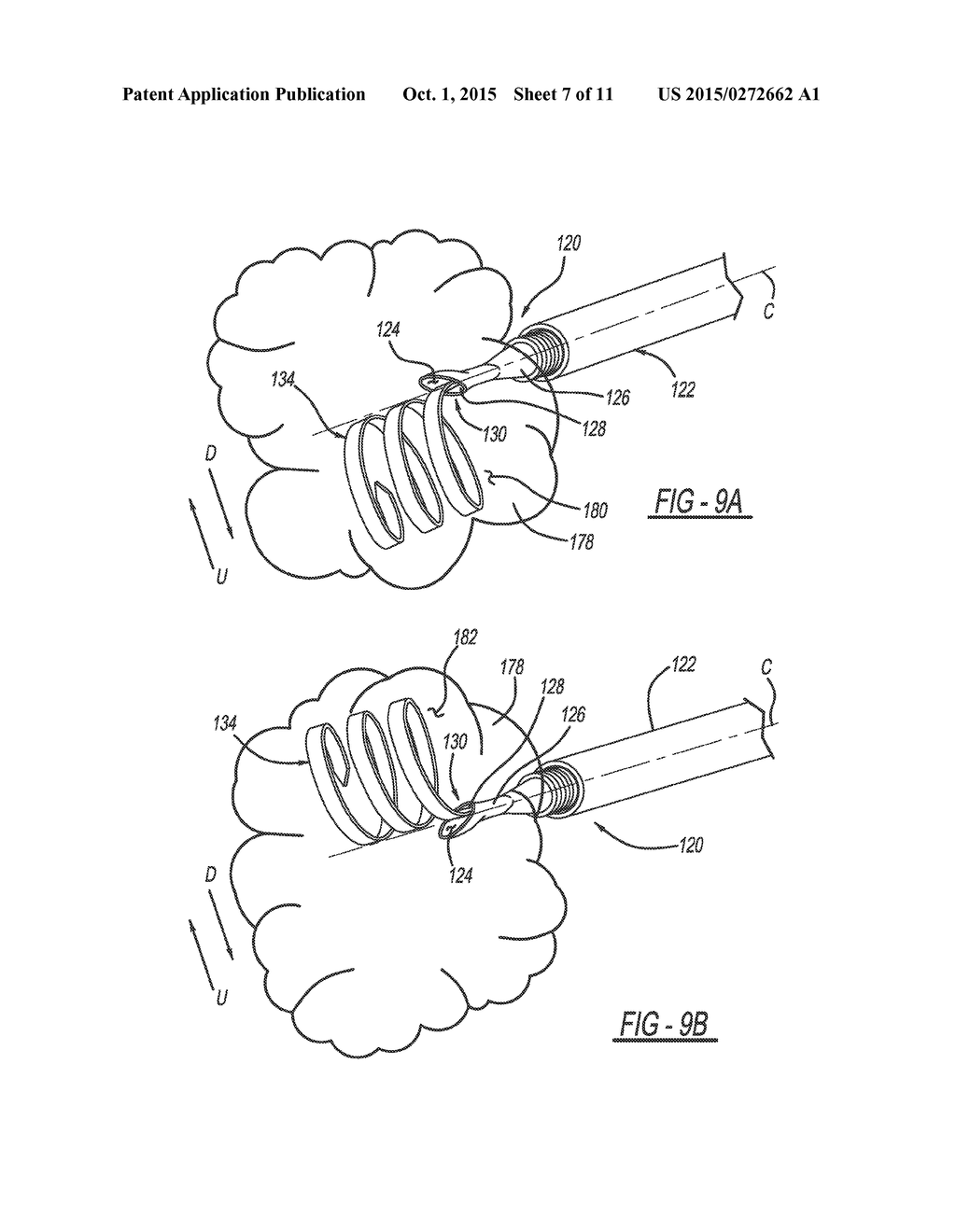 SYSTEM AND METHOD FOR PREDICTABLE DEPLOYMENT OF A MEDICAL DEVICE - diagram, schematic, and image 08