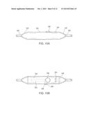 ABLATION CATHETER SYSTEM WITH SAFETY FEATURES diagram and image