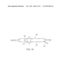 ABLATION CATHETER SYSTEM WITH SAFETY FEATURES diagram and image