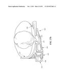 MULTI-SITE SURGICAL DRAPE AND METHOD diagram and image