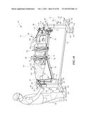 MULTI-SITE SURGICAL DRAPE AND METHOD diagram and image