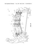 MULTI-SITE SURGICAL DRAPE AND METHOD diagram and image