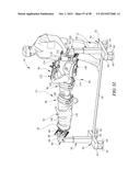 MULTI-SITE SURGICAL DRAPE AND METHOD diagram and image