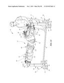 MULTI-SITE SURGICAL DRAPE AND METHOD diagram and image