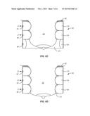 BREAST SUPPORT AND IMMOBILIZATION DEVICE FOR RADIOTHERAPY diagram and image