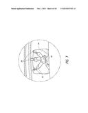 METHODS AND APPARATUSES FOR FLUORO-LESS OR NEAR FLUORO-LESS PERCUTANEOUS     SURGERY ACCESS diagram and image