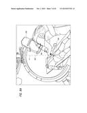 METHODS AND APPARATUSES FOR FLUORO-LESS OR NEAR FLUORO-LESS PERCUTANEOUS     SURGERY ACCESS diagram and image