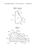 Directional Tissue Expander diagram and image