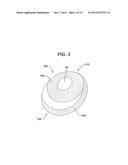 Directional Tissue Expander diagram and image