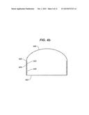 Directional Tissue Expander diagram and image