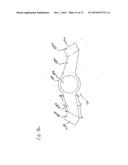 Directional Tissue Expander diagram and image