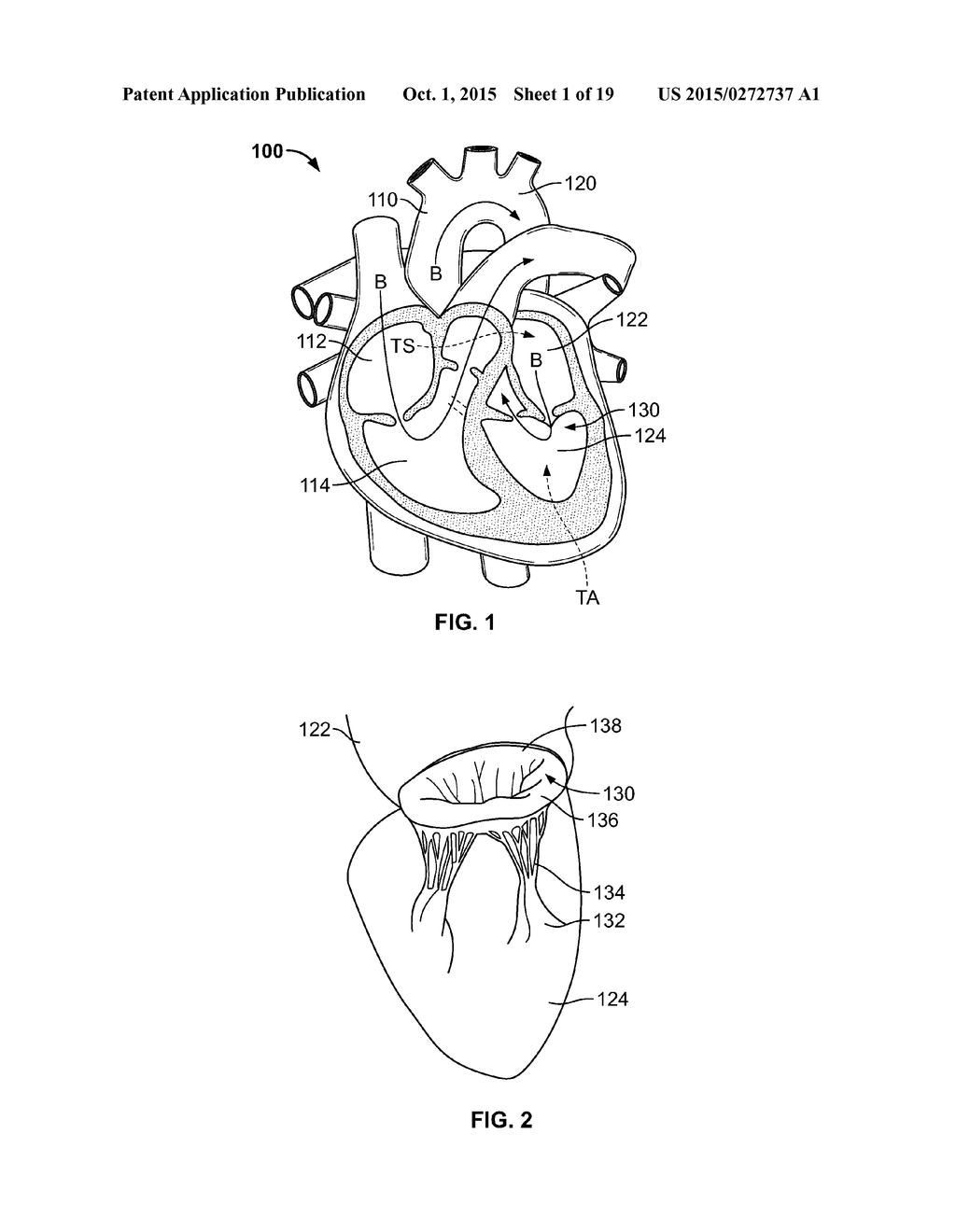 TRANSCATHETER MITRAL VALVE STENT FRAMES - diagram, schematic, and image 02