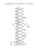 TRANSCATHETER MITRAL VALVE STENT FRAMES diagram and image