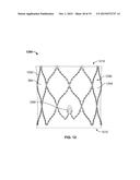 TRANSCATHETER MITRAL VALVE STENT FRAMES diagram and image