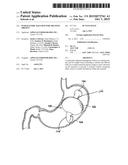 Intragastric Balloon for Treating Obesity diagram and image