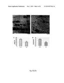 GENE THERAPY FOR GLYCOGEN STORAGE DISEASES diagram and image