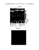 METHODS FOR THE DIAGNOSIS AND TREATMENT OF SJOGREN S SYNDROME diagram and image