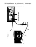 METHODS FOR THE DIAGNOSIS AND TREATMENT OF SJOGREN S SYNDROME diagram and image