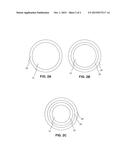 Drug Coated Balloon Catheters for Nonvascular Strictures diagram and image