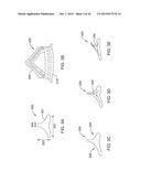 FACIAL MASK AND METHOD OF MAKING diagram and image