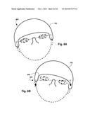 MECHANICAL AND FLUID SYSTEM AND METHOD FOR THE PREVENTION AND CONTROL OF     MOTION SICKNESS, MOTION- INDUCED VISION SICKNESS, AND OTHER VARIANTS OF     SPATIAL DISORIENTATION AND VERTIGO diagram and image