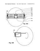 MECHANICAL AND FLUID SYSTEM AND METHOD FOR THE PREVENTION AND CONTROL OF     MOTION SICKNESS, MOTION- INDUCED VISION SICKNESS, AND OTHER VARIANTS OF     SPATIAL DISORIENTATION AND VERTIGO diagram and image