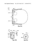 MECHANICAL AND FLUID SYSTEM AND METHOD FOR THE PREVENTION AND CONTROL OF     MOTION SICKNESS, MOTION- INDUCED VISION SICKNESS, AND OTHER VARIANTS OF     SPATIAL DISORIENTATION AND VERTIGO diagram and image