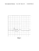 GARMENT TO FACILITATE ELECTRODE PLACEMENT FOR INTRAOPERATIVE MONITORING diagram and image