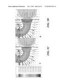 Device and Method for Deep Transcranial Magnetic Stimulation diagram and image