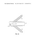 BIOACTIVE COMPOSITES OF POLYMER AND GLASS AND METHOD FOR MAKING SAME diagram and image