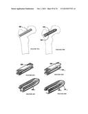 BIOACTIVE COMPOSITES OF POLYMER AND GLASS AND METHOD FOR MAKING SAME diagram and image