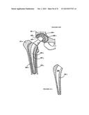 BIOACTIVE COMPOSITES OF POLYMER AND GLASS AND METHOD FOR MAKING SAME diagram and image