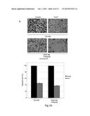 NEUTRALIZING RNA APTAMERS AGAINST PDGFBETA AND USES THEREOF IN THE THERAPY     AND DIAGNOSIS OF HYPERPROLIFERATIVE DISEASES diagram and image